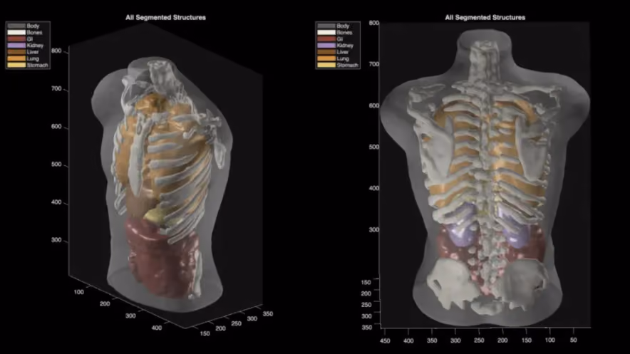 Two 3D renders of a translucent human torso revealing the skeleton and color-coded organs, bones, lungs, liver, kidneys, and digestive tract, under the heading "All Segmented Structures."