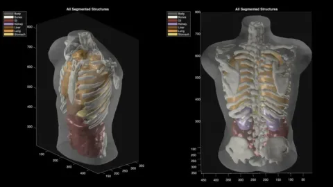 Two 3D renders of a translucent human torso revealing the skeleton and color-coded organs, bones, lungs, liver, kidneys, and digestive tract, under the heading "All Segmented Structures."